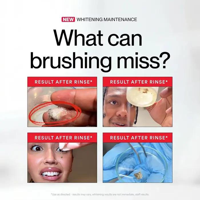 Bain de bouche blanchissant anti-taches 237ml – Haleine fraîche, sans alcool, doux pour l'hygiène buccale quotidienne et les soins bucco-dentaires pour gencives sensibles