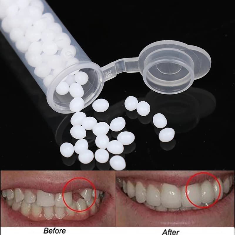 Kit de Réparation Temporaire des Dents, Fausses Dents, Colle Solide, Outil de miles, Prothèse Adhési